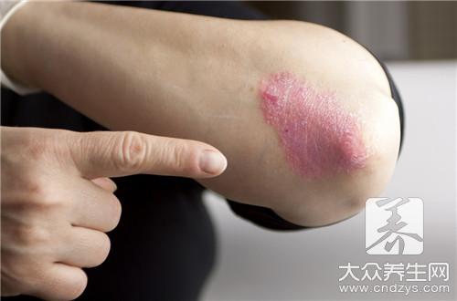 �촯��ʲôҩ�����